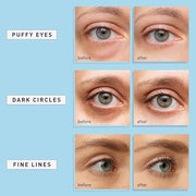 Enaskin Naturals Under Eye Patches for Dark Circles: 30 Pairs Retinol Collagen Eye Gels Mask - Reduce Wrinkles Puffy & Bag...