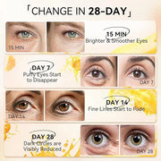 LANBENA Vitamin C Under Eye Patches for Dark Circles and Puffy Eyes, Cooling Eye Masks for Eye Bags, Fine Lines & Wrinkles...