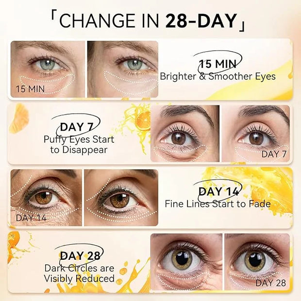 LANBENA Vitamin C Under Eye Patches for Dark Circles and Puffy Eyes, Cooling Eye Masks for Eye Bags, Fine Lines & Wrinkles...