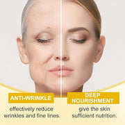 2PCS Revive Eye Cream,Revive Eye Cream For Neck, Reduces Wrinkles Firming & Hydrating Cream for All Skin Types - Product I...