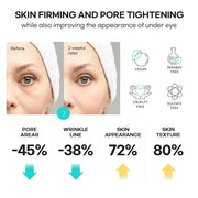 SLIKDERMIS Retinol Eye Cream for Dark Circles: Under Eye Cream for Wrinkles, Anti Aging - Eye Care, Advanced Formula Night...