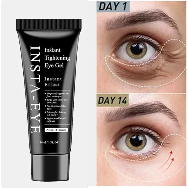 Instant Eye Tightener Cream,Under Eye Tightening Cream for Firm and Smooth the Look of Fine Lines,Reduces Dark Circles, Ba...