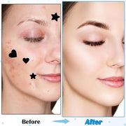 288pcs Pimple Patch Star, 2 Styles Star Pimple Patch, Cute Black Pimples Patches Stars, Skin-friendly, Breathable, Waterpr...