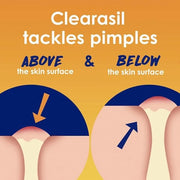 Clearasil Acne Treatment Facial Cleansing Pads, Stubborn Acne Control 5-in-1 Daily Pads, 90 Pads (Pack of 3) - Product Image