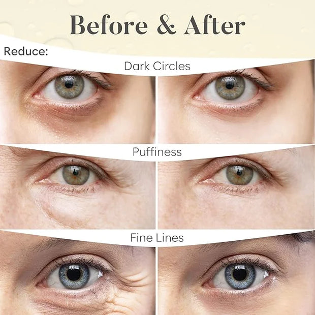 24K Gold Under Eye Patches (30 Pairs) Under Eye Patches for Dark Circles, Under Eye Patches for Puffy Eyes and Dark Circle...