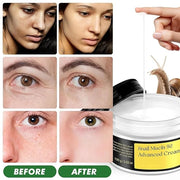 Snail Mucin 92% Repair Cream Face Moisturizer, Body Hydrating for Dry & Sensitive Skin, Snail Gel Essence Daily Serum for ...