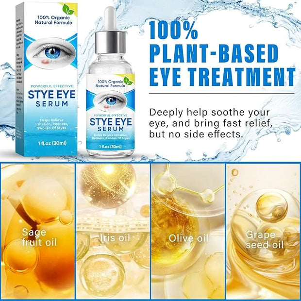 Stye Eye Treatment, Natural Stye Eye Relief Serum, for Styes Chalazion and Blepharitis Treatment, Restored Healthier Eye S...
