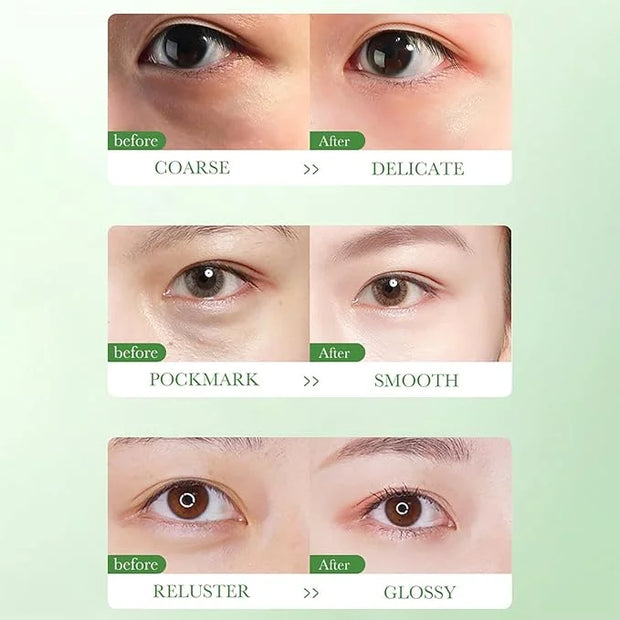 BIOAQUA Centella Asiatica Nourish Repair Eye Cream Soothing Oil Control Anti-Acne 20g / 0.7oz - Product Image