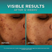 L’Oréal Paris Bright Reveal 12% [Niacinamide + Amino Sulfonic + Ferulic] Dark Spot Serum 1oz + Moisturizer Sample - Produc...