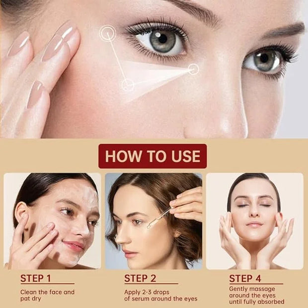 Chalazion Eye Treatment For Blepharitis, 2 PCS Moisturize Eyelids Serum and Chalazion Remover, Gentle Under Eye Relief Ser...