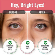 Under Eye Patches for Dark Circles and Puffiness (20 Pairs) - Korean Skin Care Caffeine Collagen Eye Patches for Puffy Eye...