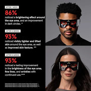 Luminator LED Eye Mask for Men and Women Skincare - Anti-Aging, Boost Collagen, Reduce Dark Circles & Wrinkles, Red Light ...