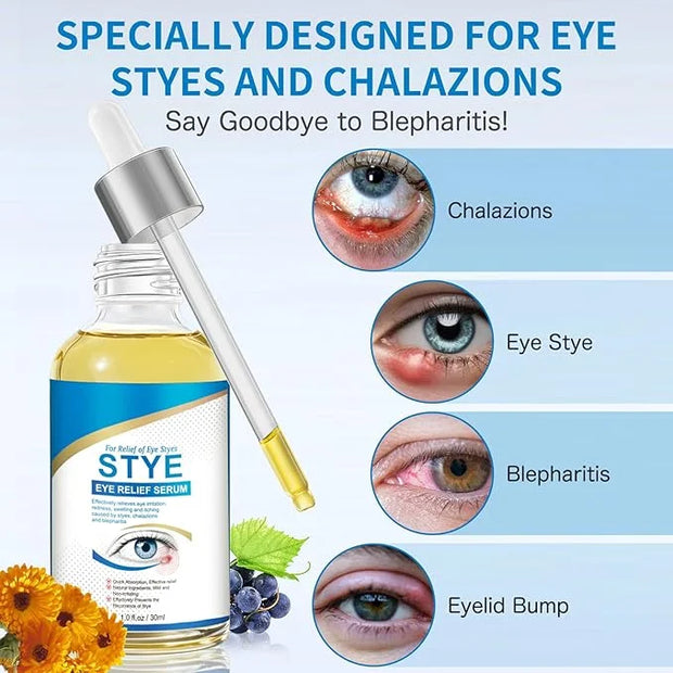 Stye Eye Treatment, Natural Stye Relief Serum for Styes, Chalazions and Blepharitis, Quickly Relieves Eye Irritation and R...