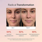 Solawave 4-in-1 Radiant Renewal Facial Wand & Skin Therapy Serum Bundle | Red Light Therapy for Face and Neck | Galvanic S...