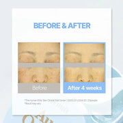 PETITFEE Aura Quartz Hydrogel Eye Mask Blue 60 pcs (30 pairs) - Eye Patch for Dark Circles, Brightens Under Eyes, Glutathi...