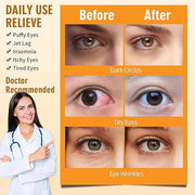 Serfeymi steam eye masks relieve