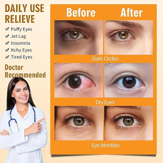 Serfeymi steam eye masks relieve
