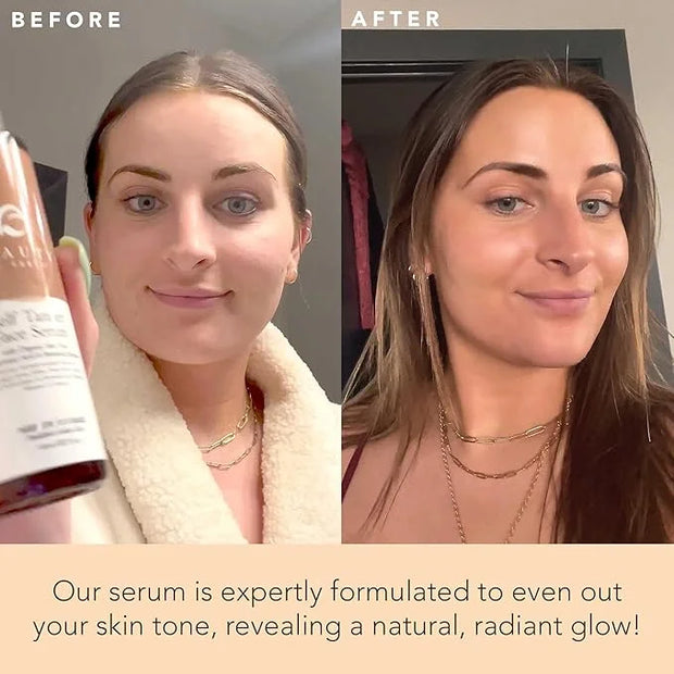 Face Tanner Serum - Fair to Medium Sunless Tanner for Face Sunless Tanner with Hyaluronic Acid - Self Tanner for Face Self...