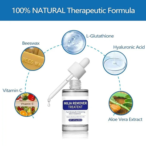 Milia Remover Treatment Serum, Milia Remover for Eyes & Face，Deep Clear to Get Glow Skin 0.85 oz - Product Image