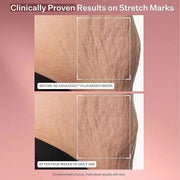 StriVectin Anti Wrinkle Trio Kit for Face and Eyes, 3 piece kit with SD Plus Moisturizer, Peptide Plump Line Face Serum, a...