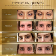 Hydrogel Eye Patches for Dark Circles, Puffy Eyes & Wrinkles - Collagen & Hyaluronic Acid Infused Under Eye Masks, Hydrati...