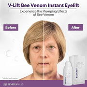 Beverly Hills V-lift Instant Eye Lift & Mens Instant Facelift Bundle with Discount - Eye Serum Treatment for Dark Circles,...