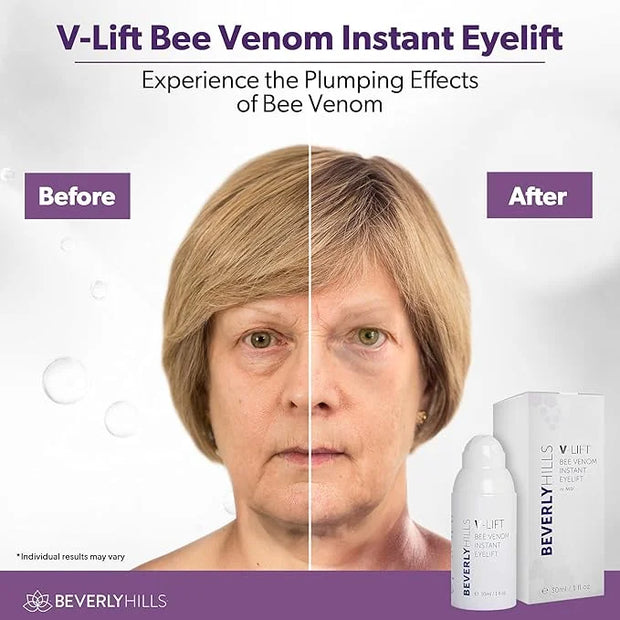 Beverly Hills V-lift Instant Eye Lift & Mens Instant Facelift Bundle with Discount - Eye Serum Treatment for Dark Circles,...