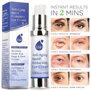 TEREZ & HONOR Anti-Aging Rapid Reduction Under-Eye Cream, Visibly and Instantly Reduces Wrinkles, Dark Circles and Eye Bag...