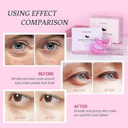 Under Eye Patchs Rose Eye Mask for Dark Circles and Puffiness Wrinkle Eye Bags 30 Pairs - Product Image