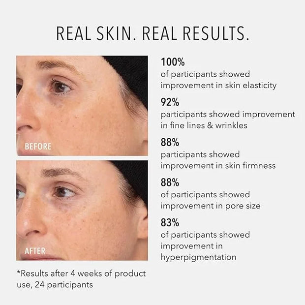 HydroPeptide Retinol Routine Booster, 1% Universal Tri-Retinol Complex Peptide Solution, 1 Ounce - Product Image