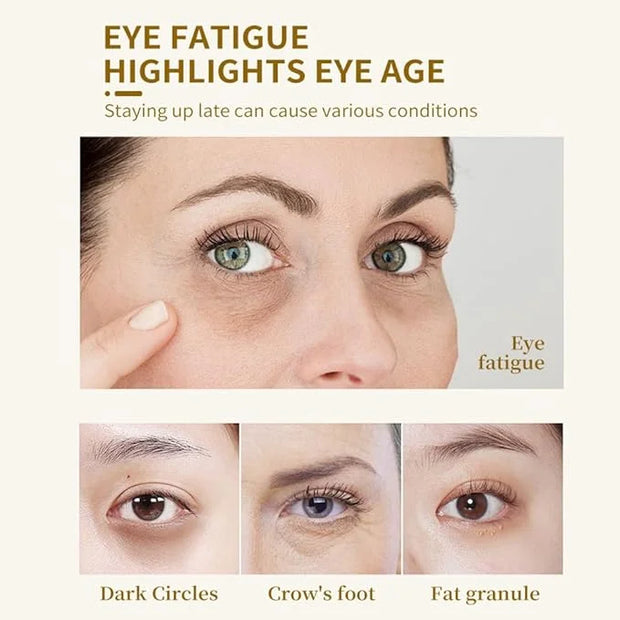 20 Pairs Under Eye Patches, Collagen Crystal Eye Mask for Dark Circles and Puffiness - Anti Aging Under Eye Mask. - Produc...