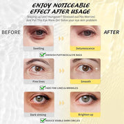 Under Eye Patches(30 Pairs), 24K Gold, Caffeine, Hyaluronic Acid, Aloe Vera Eye Masks for Dark Circles Puffy Eyes Undereye...