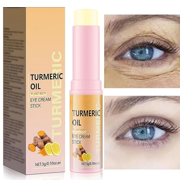 Turmeric Retinol Eye Stick, Turmeric Booster Eye Cream, Anti Aging and Hydrating Under Eye Cream for Dark Circles Puffines...