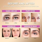 Under Eye Patches for Dark Circles: Anti-Wrinkle Eye Cream with Hyaluronic Acid - Reduce Under Eye Bags - Product Image
