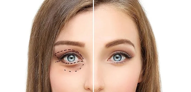Osmotics Under Eye Rejuvenator, Anti Aging Eye Cream For Dark Circles, Eye Bags, Fine Lines, Puffiness. Best Anti Aging Ey...
