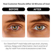 Self Heating Eye Mask - Steam Eye Mask for Dry Eyes, Soothing Relief, Stress Reduction - Disposable Warm Eye Compress Mois...