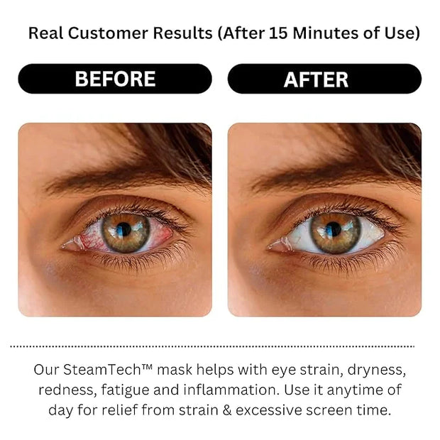 Self Heating Eye Mask - Steam Eye Mask for Dry Eyes, Soothing Relief, Stress Reduction - Disposable Warm Eye Compress Mois...