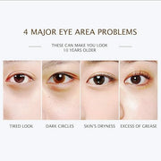 BIOAQUA 30 Pairs Eye Mask Moisturizing Hydrating Anti-Wrinkle Anti-Aging Remove Dark Circles Smooth Nourishing Refreshing ...