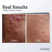 131 Daily Routine Set for Face - Acne Control, Optimal pH Balance - Skin Care Set - Product Image