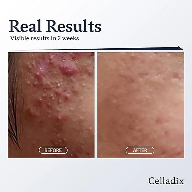 131 Daily Routine Set for Face - Acne Control, Optimal pH Balance - Skin Care Set - Product Image