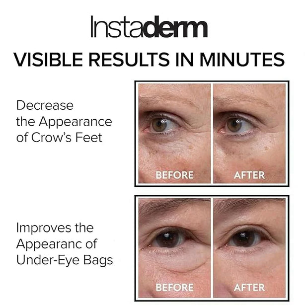 Instant Puffy Eye & Lift Treatment – Removes Under Eye Bags & Puffiness. Eliminate Dark Circles & Wrinkles. Naturally Agel...
