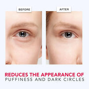 Beauty by Earth Caffeine Eye Cream for Puffiness & Bags Under Eyes - USA Made with Natural & Organic Ingredients, Under Ey...