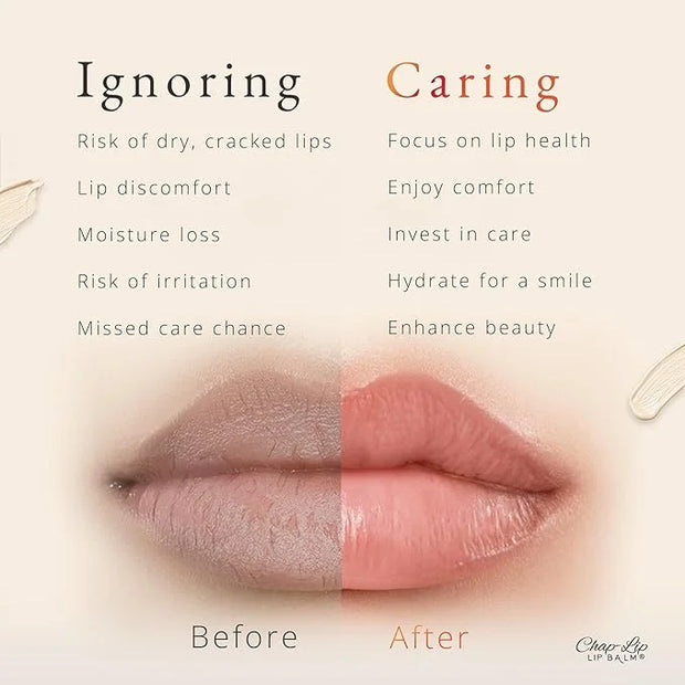 CHAP-LIP Original Lip Balm Hydrating Bulk Gift