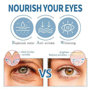 Zetiling 8 Pack Reusable Ice Gel Eye Pad for Puffy Eyes, Hot Cold Eye Mask, Deep Hydration and Anti Aging Effects - Produc...