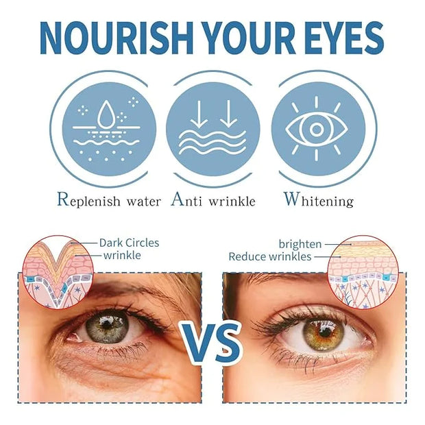 Zetiling 8 Pack Reusable Ice Gel Eye Pad for Puffy Eyes, Hot Cold Eye Mask, Deep Hydration and Anti Aging Effects - Produc...