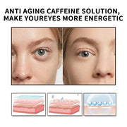Caffeine Eye Serum With EGCG For Dark Circles and Puffiness, 30ML Anti Aging 5% Caffeine Solution For Puffy Eyes, Fine Lin...