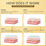 Under Eye Patches for Puffy Eyes and Dark Circles, 20 Pairs Eye Mask with Hyaluronic Acid & Collagen, Anti Wrinkle Patches...