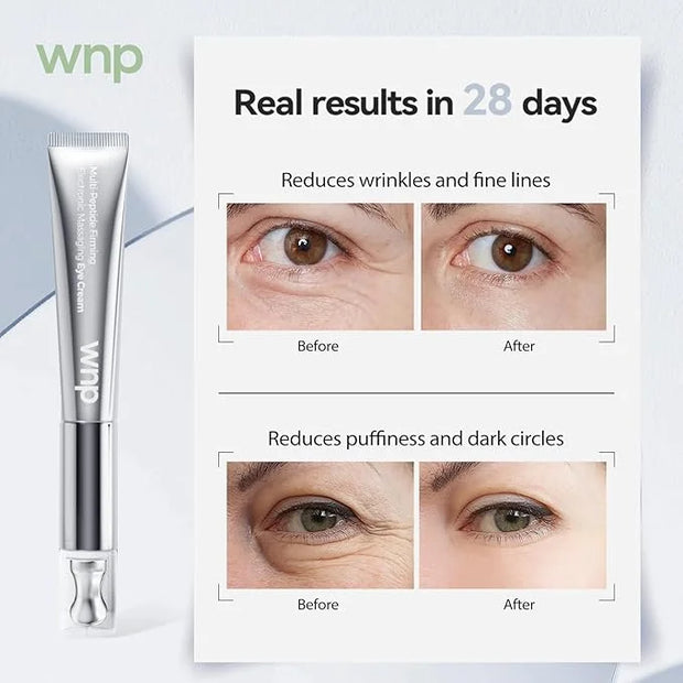 Eye Cream|Wrinkle Eraser Massaging Eye Cream, Multi-peptide Firming Eye Tightener, Anti-Aging Eye Cream for Puffiness and ...