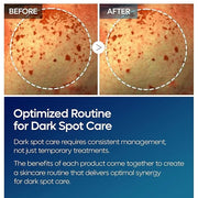 TX Tranexamic Acid Care Line TX cream+Toner+Ampoule+Cleanser Powerful Dark Spot Care | Visible Improvement in 4-8 Weeks - ...