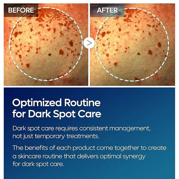 TX Tranexamic Acid Care Line TX cream+Toner+Ampoule+Cleanser Powerful Dark Spot Care | Visible Improvement in 4-8 Weeks - ...